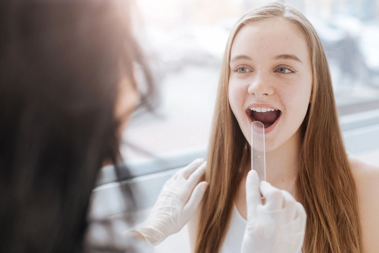 Efectos de la bulimia en la cavidad oral.